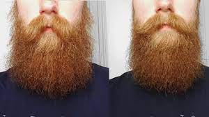 Oft kommen fragen zu meinem bart, oft ist erthema in den kommentaren hier ein paar antworten. Bart In Form Bringen Mit Rundburste Und Fon Manner Styling Tutorial Youtube
