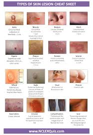 Types Of Skin Lesion Cheat Sheet Pediatric Nursing Nurse Practitioner School Nursing Assessment