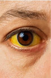 Image result for Sclera