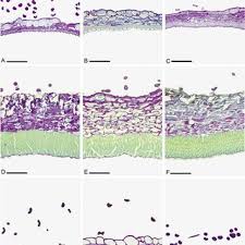 Image result for Pearsonia mesopontica