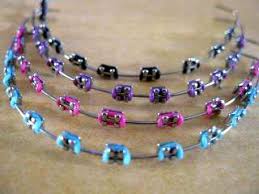 Choose dye from the above option (choose from: Fake Braces The New Status Symbol For Asian Teenagers Diy Braces Fake Braces Teeth Braces