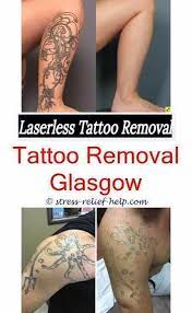 Tattoo Eraser How Long Does Tattoo Removal Take Does Kaiser Insurance Cover Tattoo Removal Tattoo Rem Tattoo Removal Cream Tattoo Removal Tattoo Removal Cost