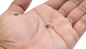 Nasal polyps are not the same as a boil or abscess which occurs as a result of an infection. Nasal Polyps Healthily