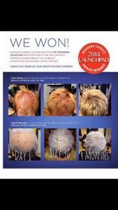 8 Eufora Ideas Hair Care Hair Edges Hair