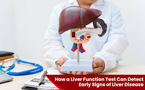 Image result for Liver Function Test