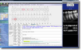 Dental Practice Software Easy Dental Software Thats