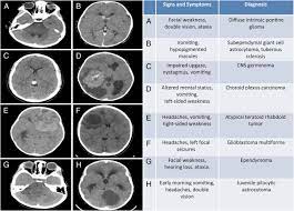 Basically a growth of abnormal cells in your brain, a brain tumor can be understanding brain tumor symptoms early can mean a better shot at a positive outcome. Childhood Brain Tumors American Academy Of Pediatrics