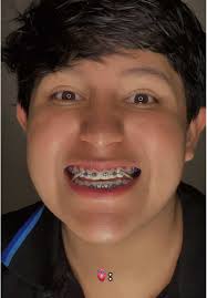 La tristeza detrás de la canción y la ansiedad