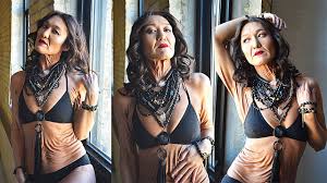 26-Year-Old Woman With Rare Disorder Challenges Beauty Standards ...