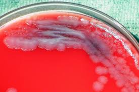 Image result for Anthrax