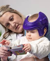 متى يصبح التعرّق داخل خوذة علاج تسطح الرأس خطيرًا؟