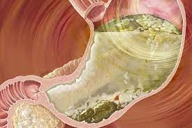 Pin On Chronic Fatigue Me Fibromyalgia