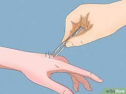 Let the adhesive dry, then pull the edges of the cement up slowly and carefully. 3 Ways To Remove Cactus Needles Wikihow