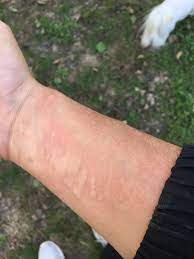 Allergy To Dog S Saliva Milos Zikic Blog