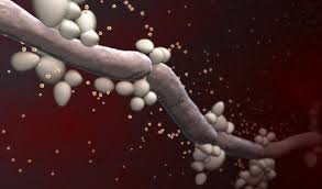 Candidiasis - Infección Sexual