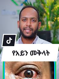 Pterygium Surgery Overview at Ethiotebib Hospital