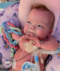 Waiting for genetic test results for Amaya's diagnosis