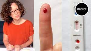 Online sales are banned) only to be used by people aged 15 and over without symptoms; We Test A Home Antibody Kit For Tracking Covid 19