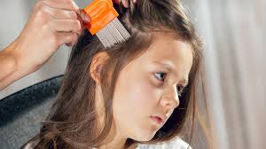 How to get rid of lice: treatments, shampoos and what really works