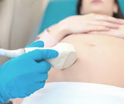 Download application for android and ios, best replacement for the play store and the appstore for your smartphone. Einleitung Der Geburt Wenn Die Wehen Nicht Von Selber Kommen Mammacita