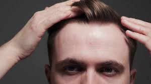 From natural to dramatic colors. This Guy Just Shared 5 Tips For Hiding A Receding Hairline