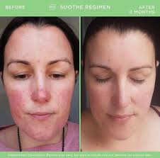 Heather, DeVon, Kristen, Ginger, Rachel, and Rebecca have concerns with  redness/irritation...👇🏽