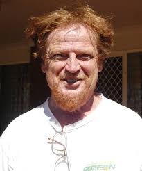 Motorcycle crash resulting in severe burn scars and injuries