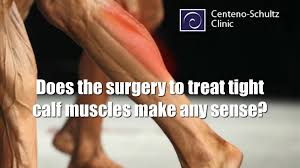 Tight calf muscles can be a bummer for runners, as they can feel stiff and sore after what we think of as the calf muscle in our lower leg is actually made up of two muscles: Surgery To Lengthen A Tight Calf Muscle Stem Cell Blog