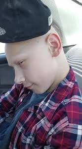 Hunter Lantz, Bone Marrow Transplant