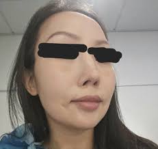 Amazing Experience and Doctor !