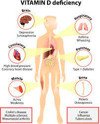 Know the symptoms of vitamin d deficiency and how to prevent it. Do You Fear Having A Vitamin D Deficiency Paper Boys Club