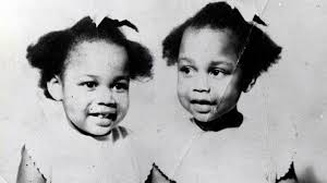 Cặp song sinh liền thân xinh đẹp nhất thế giới, kết hôn với hai ông chồng  nhưng đến chết vẫn cô quạnh