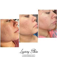 Luxury Skin Scottsdale, 4301 N 75th St, Scottsdale, AZ 85251, US