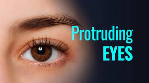 Choose from more than 6,000 properties, ideal house rentals for families, groups and couples. Protruding Eyes What Is My Eye Shape Youtube