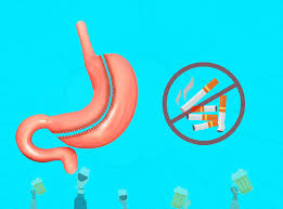 Das Rauchen Nach Schlauchmagen Dr He Obesity Clinic