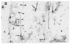 _ as long as you won't make a mess in my bedroom, you can share it with me. Ijms Free Full Text Bridging The Gap Between Alzheimer S Disease And Alzheimer S Like Diseases In Animals Html