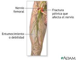 Dano Al Nervio Femoral Medlineplus Enciclopedia Medica Illustracion