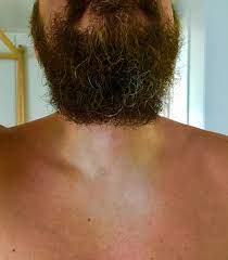 Beard Problems (Tan Lines) : r/beards