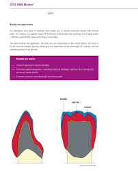 vita vmk master dental expert