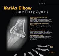 VariAx Elbow Locking Plate System Selling Sheet - Stryker