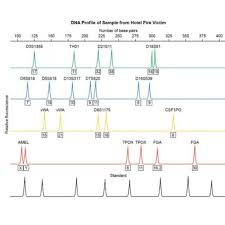 Identify the sections of dna that tend to differ and use pcr to amplify these segments. Dna Profiling Activity