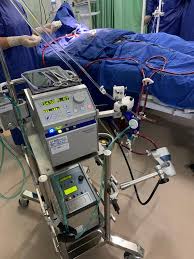 We did not find results for: Ecmo Tratamento Utilizado Por Paulo Gustavo Ja Foi Aplicado Em 56 Pacientes Em Fortaleza Coronavirus Em Fortaleza Ceara E Mundo Ultimas Noticias No O Povo Online