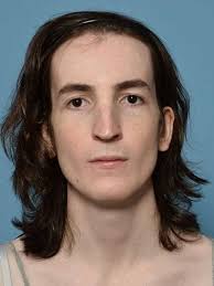 Facial Feminization Reston