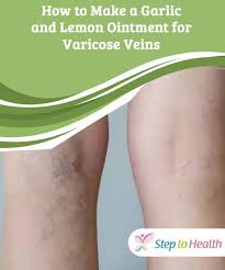 Pin On Natural Remedies