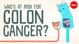 Symptoms of colon cancer include changes in bowel habits and unexplained abdominal pain. Colorectal Cancer Colon Cancer Rectal Cancer Columbia University Department Of Surgery