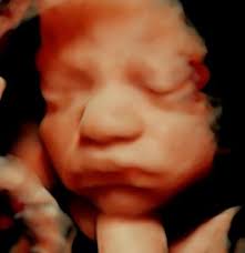 EcografÍa Fetal Monterrey