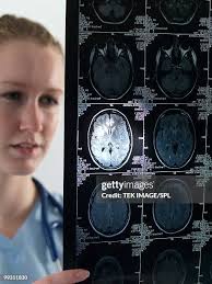 30,814 The X Ray Stock Photos, High-Res Pictures, and Images