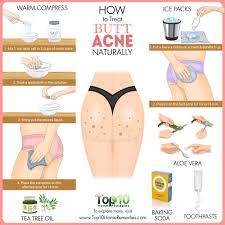 And of course, it's not a problem, you often see others have, because we wear clothes for most of the time. How To Treat Butt Acne Naturally Top 10 Home Remedies