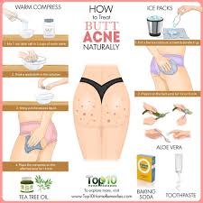 Check spelling or type a new query. How To Treat Butt Acne Naturally Top 10 Home Remedies