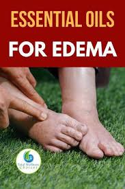 Top 5 Essential Oils For Swollen Feet And Ankles Foot Remedies Swollen Feet Remedy Natural Healing Remedies